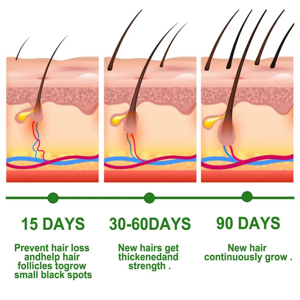 jamalalhayat™Rosemary Essential Oil For Hair Care
