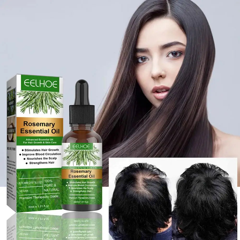 jamalalhayat™Rosemary Essential Oil For Hair Care