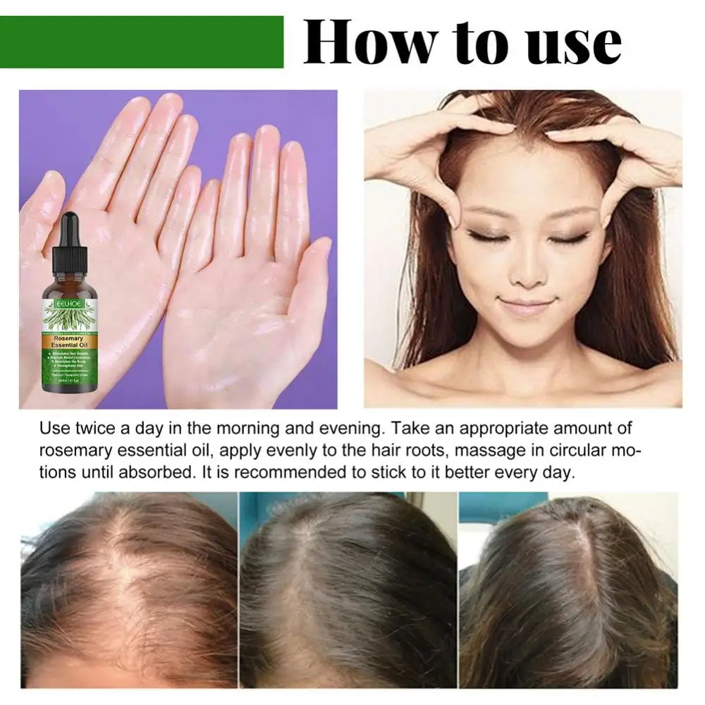 jamalalhayat™Rosemary Essential Oil For Hair Care
