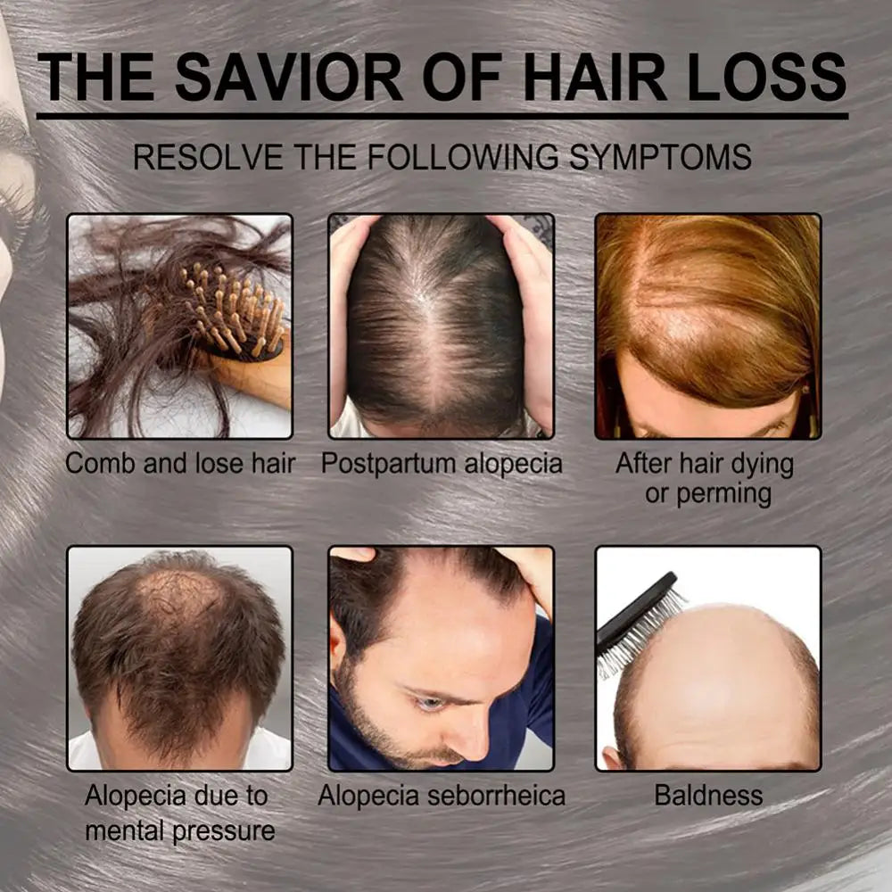jamalalhayat™Rosemary Essential Oil For Hair Care