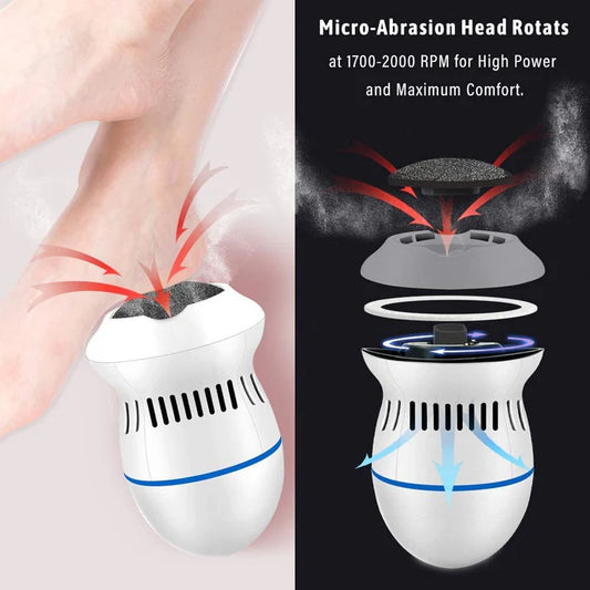 Jamalalhayat™Electric Callus Remover – مزيل الجلد الميت الكهربائي